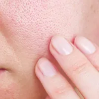Pore Cleaning